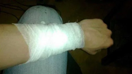 У Луцьку в пенсійному фонді чоловік намагався порізати вени