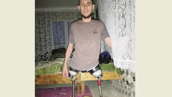 «Доповз до мертвих побратимів і чекав кінця»: захисник з Волині втратив обидві ноги та пережив клінічну смерть