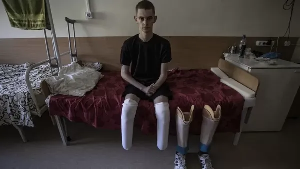 «Через поранення російський командир пропонував застрелити», – історія військового волинської бригади