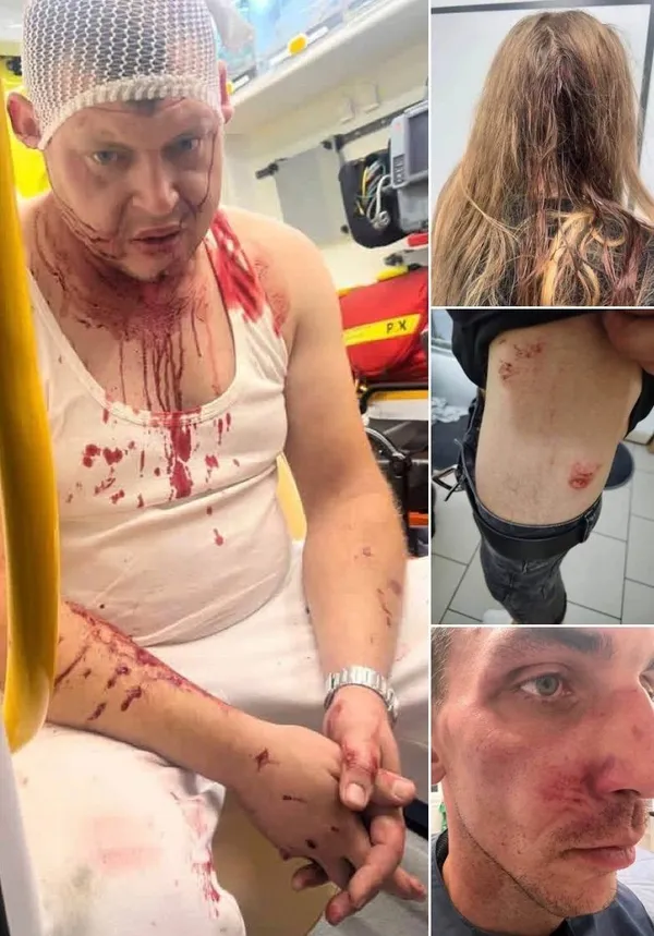 «Спєрдаляй на Україну»: у Польщі біля хостелу побили трьох українців (фото)