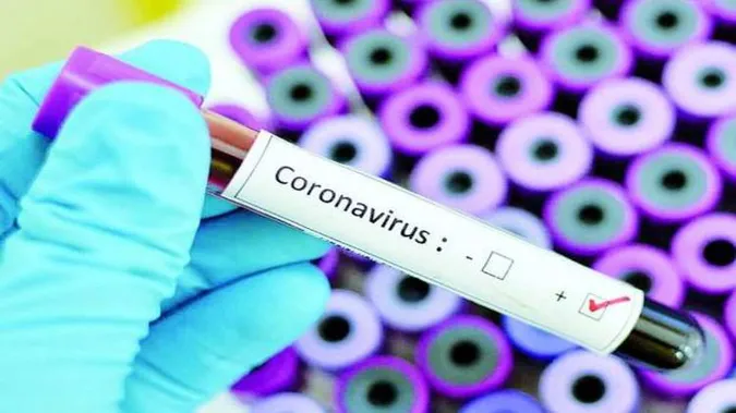 В Україні – 218 хворих на COVID-19, за добу – 62 випадки