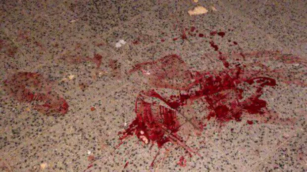 20 ударів ногами по голові: п'яний волинянин відгамселив знайомого