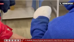 Хлопчику відірвало пальчик: що відомо про поранених внаслідок ракетних ударів у Львові (відео)