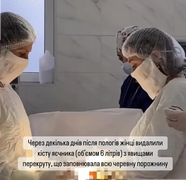 Врятували маму та немовля: на Волині після пологів прооперували жінку з величезною кістою (фото 18+)