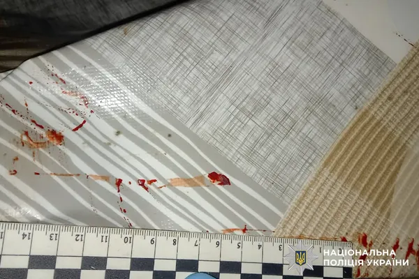 Звинуватив у крадіжці: на Рівненщині чоловік відрубав знайомому два пальці (фото)