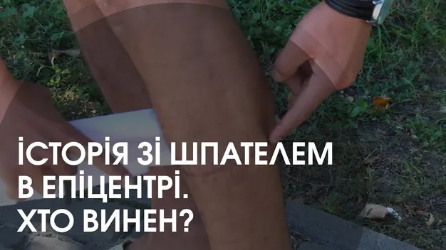 Лучанин поранився шпателем в «Епіцентрі»: хоче компенсацію (відео)