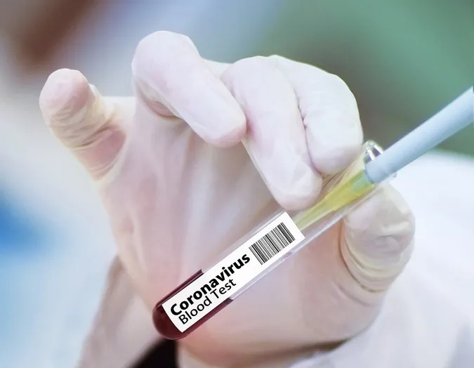 Скільки часу після COVID-19 залишається ризик утворення тромбів