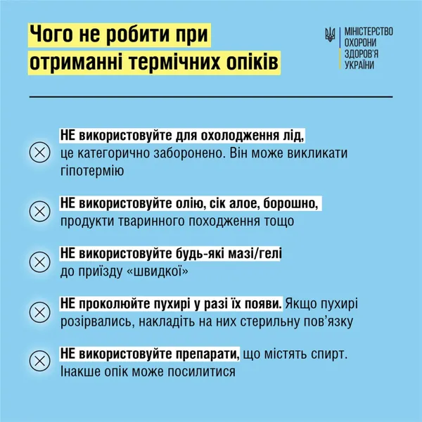 У МОЗ порадили, що робити при термічних опіках