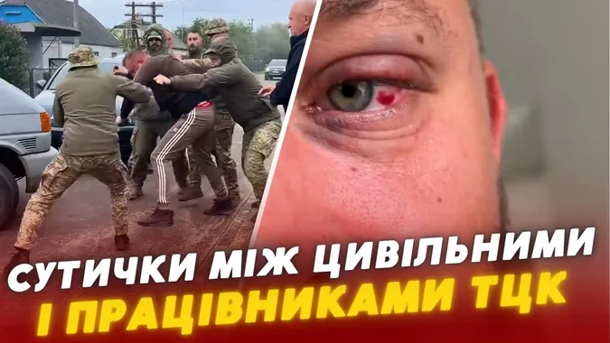 «Запшикали балончиком і душили»: на Волині ветеран заявив про побиття працівниками ТЦК (відео)