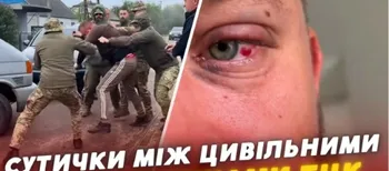 «Запшикали балончиком і душили»: на Волині ветеран заявив про побиття працівниками ТЦК (відео)