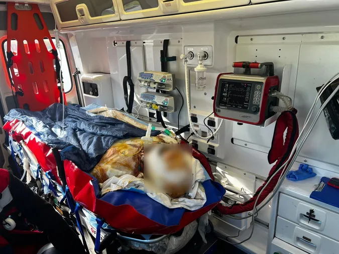 Волинські медики доставили до аеропорту в Польщі пацієнта з понад 36% опіків тіла (фото)