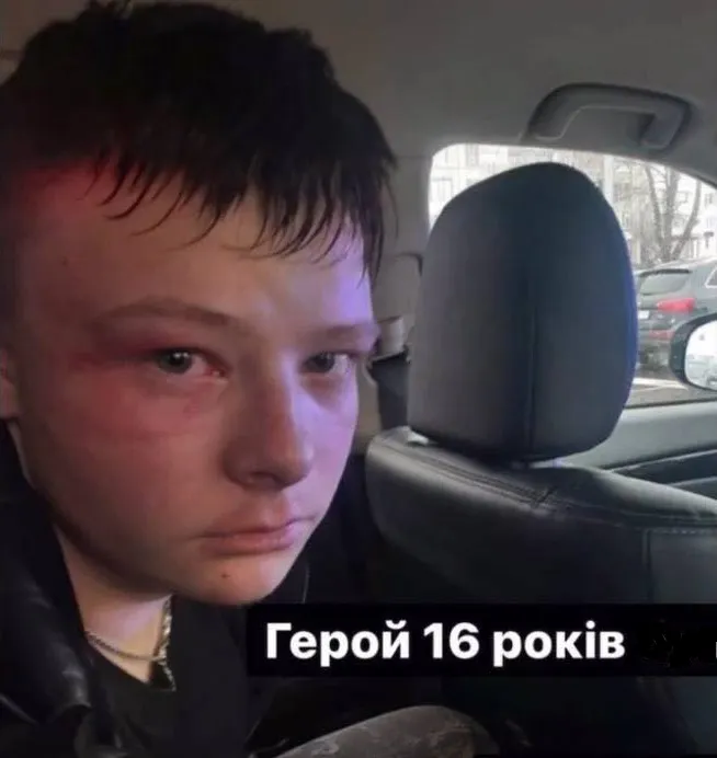 Стало відомо ім'я підлітка, який влаштував жахливу ДТП біля «Там Таму» в Луцьку (фото)