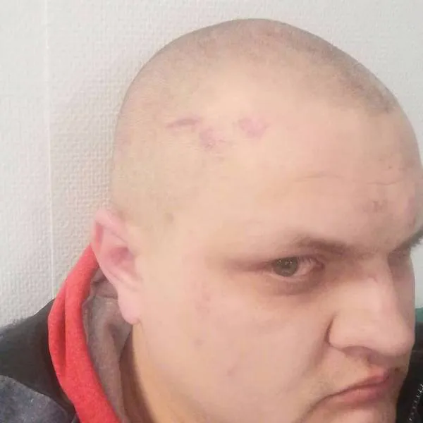 Через національність, – побитий українець розповів деталі нападу в Польщі