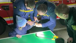 Частина іграшки застрягла на пальці: луцькі надзвичайники допомогли 4-річній дівчинці (фото)
