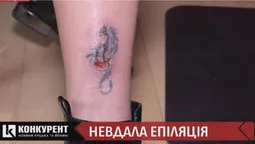 Лазерна епіляція у луцькому салоні завершилася опіком: що кажуть лікарі (відео)