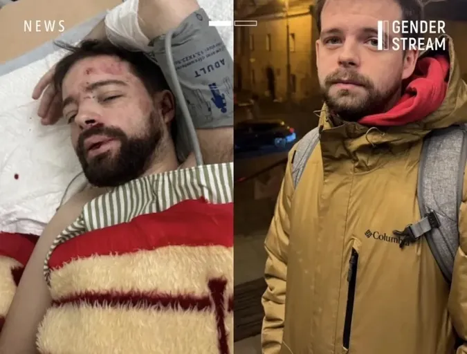 Вистрибнув з авто на ходу: що сталося з мобілізованим працівником Львівського університету (фото)