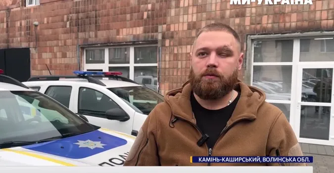 Втратив око на фронті та знайшов себе в поліції: історія ветерана Нацгвардії з Волині (відео)
