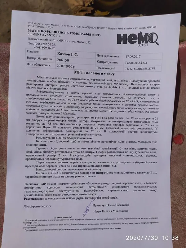 У маленького волинянина виявили пухлину мозку: потрібна допомога