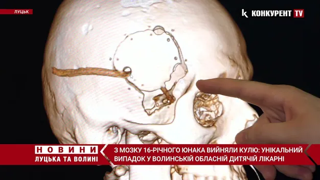Куля пройшла повз важливі ділянки: як у Луцьку оперували пораненого в голову юнака (відео)