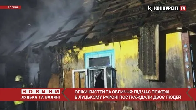 Опіки кистей та обличчя: під час пожежі в Луцькому районі постраждали двоє людей (фото, відео)