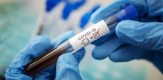 Рівень ГРВІ на Волині знижується, але кількість випадків COVID-19 подвоїлася