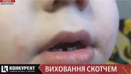 Заклеювала рот скотчем: у луцькому дитсадку вихователька знущалася з дітей (відео)