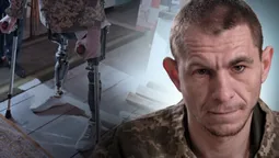«Не вважаю себе калікою»: 30-річний волинянин втратив на війні ноги, але обрав жити далі (фото)