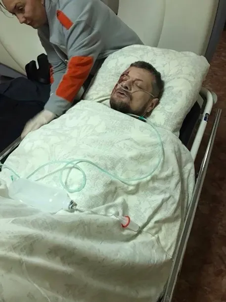 Двоє загиблих і поранений депутат Мосійчук: подробиці вибуху в Києві