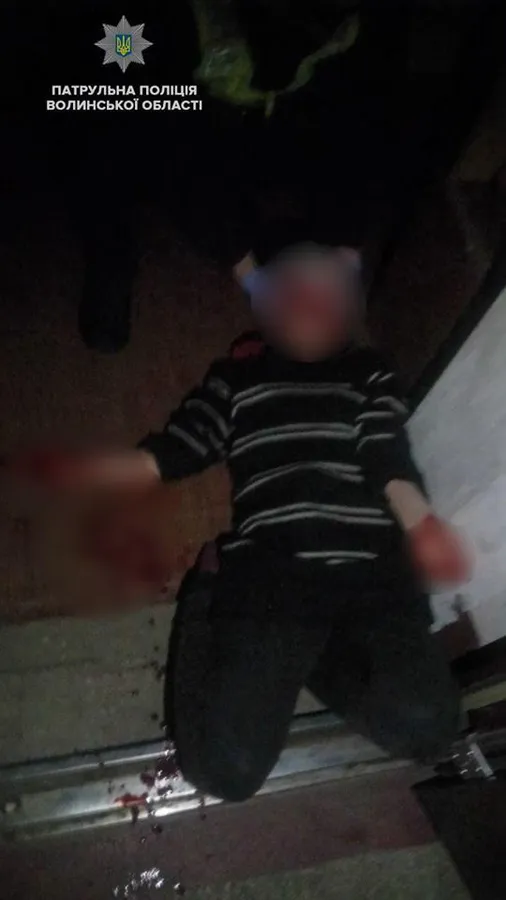 Проламали голову і покинули напризволяще: у Ковелі патрульні врятували жінку (фото, відео)