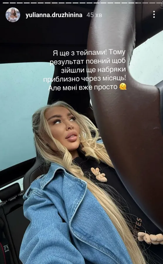 Тепер з носиком Барбі: луцька бізнеследі Дружиніна похизувалась пластикою обличчя (фото)