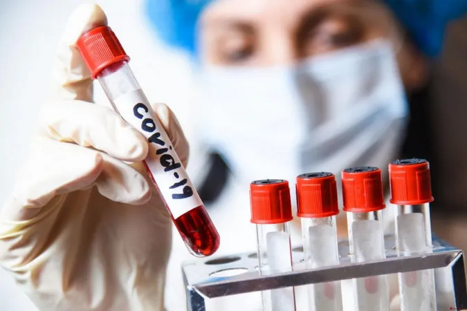 За добу в Україні – 9 012 нових випадків коронавірусу: де зафіксували