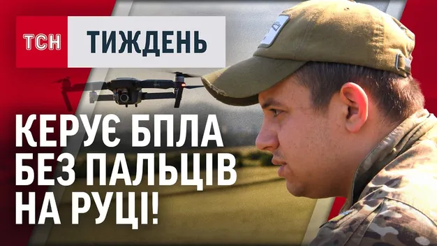 «Крабик» із волинської «сотки» керує безпілотниками, хоч втратив пальці на руці (відео)