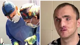 «Не було ні носа, ні щелепи»: у Луцьку канадські лікарі повернули обличчя пораненому бійцю (відео)
