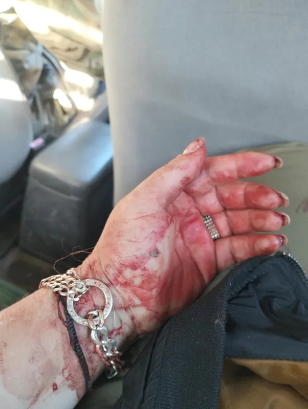 Волинська депутатка з волонтерами потрапили під обстріл на Харківщині (відео)