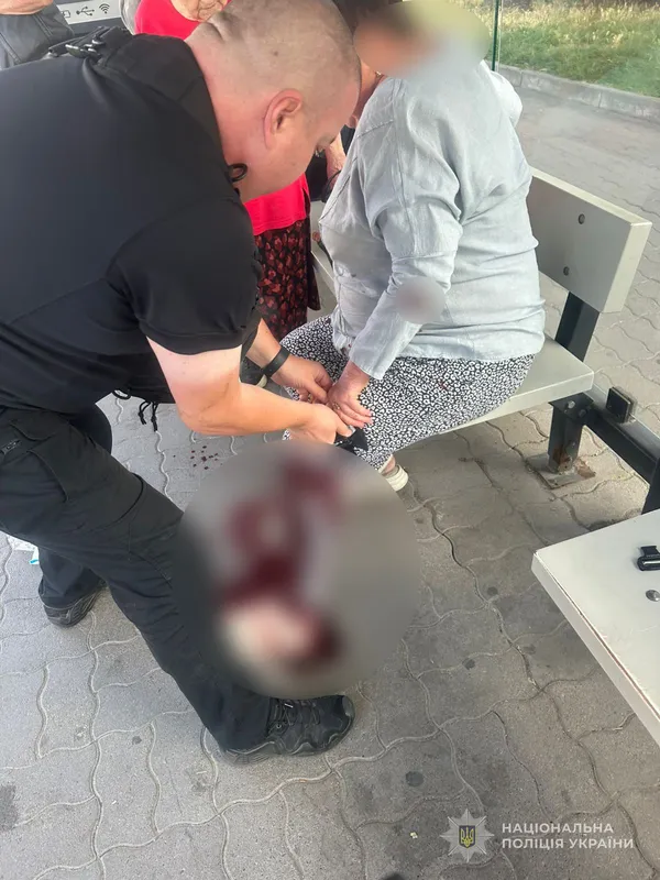 Оступилась та впала: у Луцьку поліцейські врятували закривавлену жінку (фото)