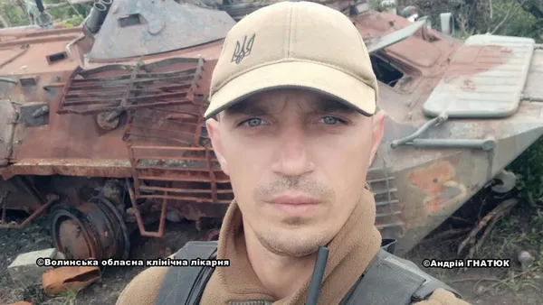 Понівечені війною: як у волинській лікарні допомагають повертати обличчя пораненим воїнам
