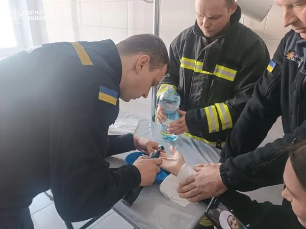 Аж набряк палець: у Луцьку дівчина наділа затісну каблучку (фото)