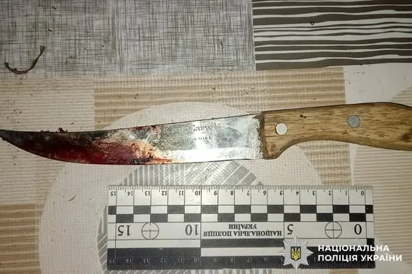 Звинуватив у крадіжці: на Рівненщині чоловік відрубав знайомому два пальці (фото)