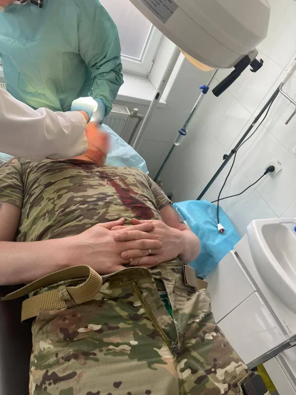 На Закарпатті місцеві жителі закидали камінням прикордонників (фото 18+)