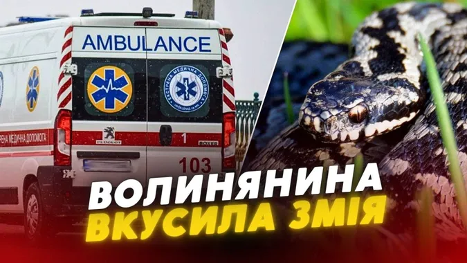 Волинянина вкусила отруйна змія: що робити, якщо це сталось з вами (відео)