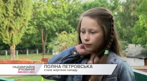 У Рівному старшокласниці побили дівчинку, бо захистилася за собаку