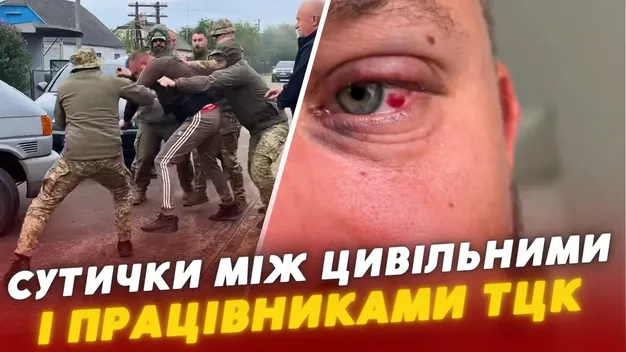 «Запшикали балончиком і душили»: на Волині ветеран заявив про побиття працівниками ТЦК (відео)