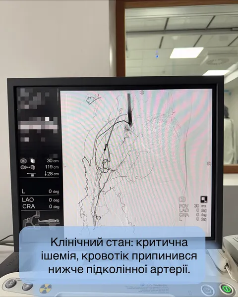 Був за крок до ампутації: на Волині лікарі врятували ногу пацієнта (фото)