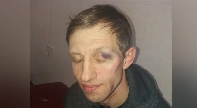 МОН вимагає покарати батька, який побив учителя фізкультури