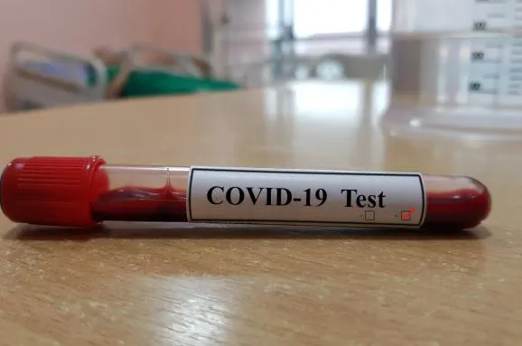 Коронавірус на Волині: за добу – 415 нових випадків і дев'ять смертей