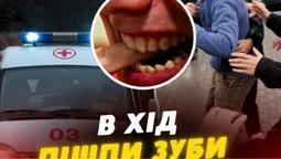 На Волині чоловік під час сварки відгриз палець супернику (відео)