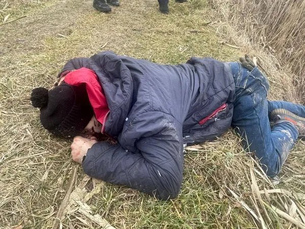 Розірвався у руці: на Волині від вибуху невідомого пристрою загинув 21-річний хлопець (фото 18+)
