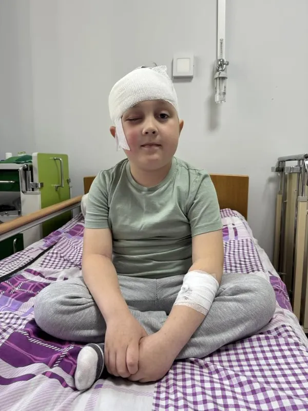 З голови маленького хлопчика з Волині видалили одну з найскладніших пухлин (фото)