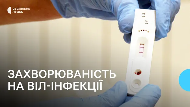 На Волині зросла кількість хворих на ВІЛ-інфекції