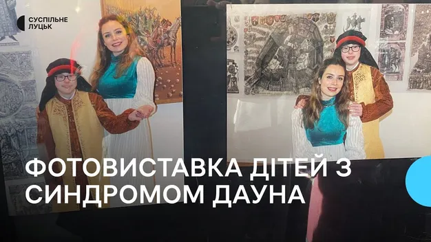 «Краса сонячними очима»: у Луцьку відкрили фотовиставку дітей з синдромом Дауна (відео)